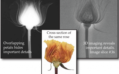 Is a 3D Mammogram Really Better Than a 2D Mammogram?