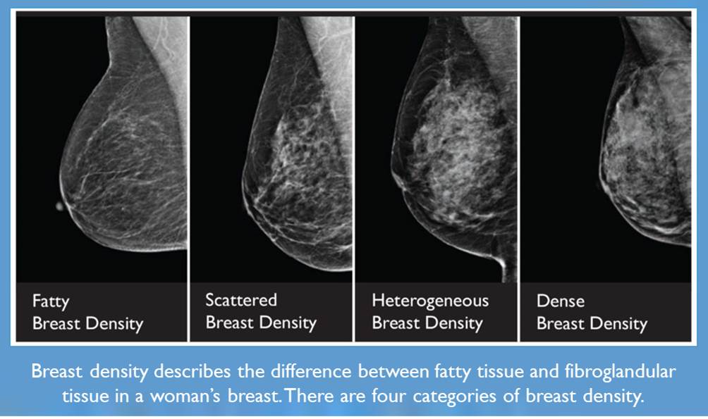 Do Dense Breasts Mean a Higher Risk of Breast Cancer? - Breast